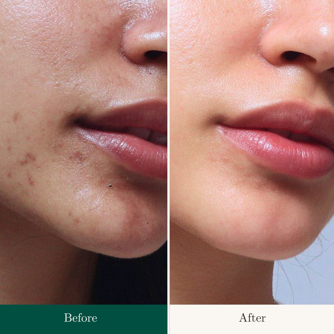 Before After 19